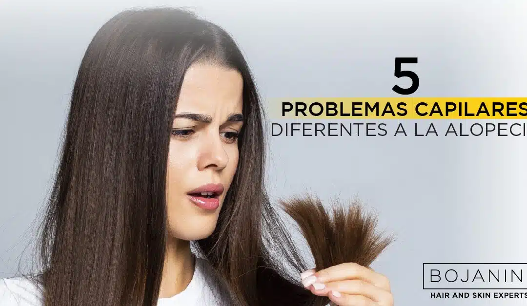 5 Problemas Capilares Diferentes A La Alopecia