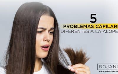 5 Problemas Capilares Diferentes A La Alopecia