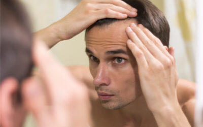  Factores genéticos de la alopecia: ¿Qué debes saber?