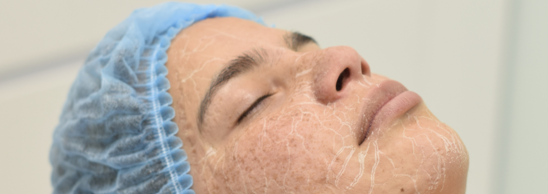 hidratación facial para la piel