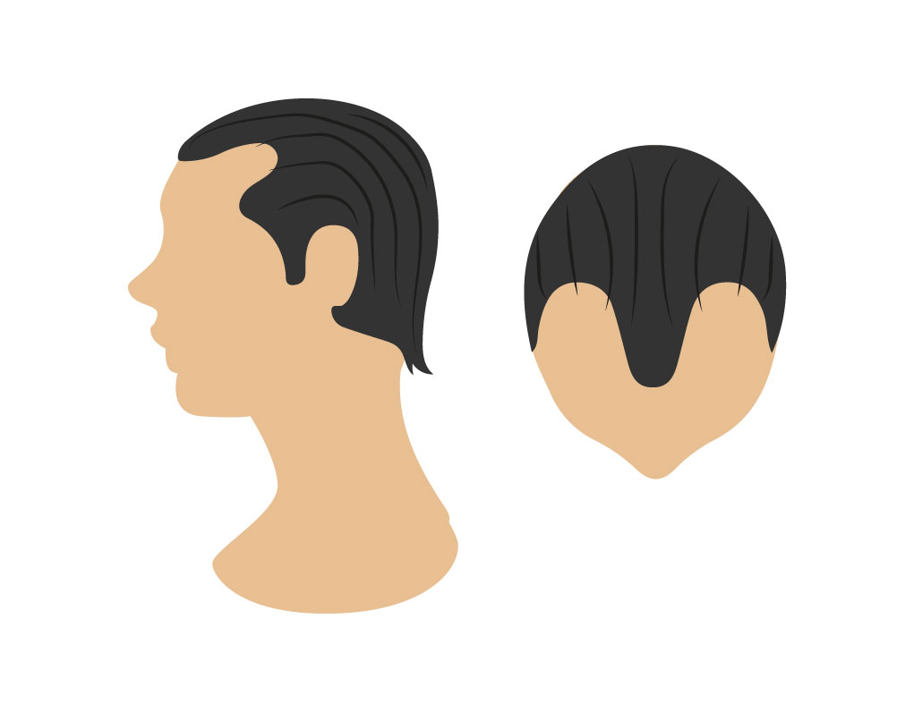 alopecias 02 Bojanini Colombia