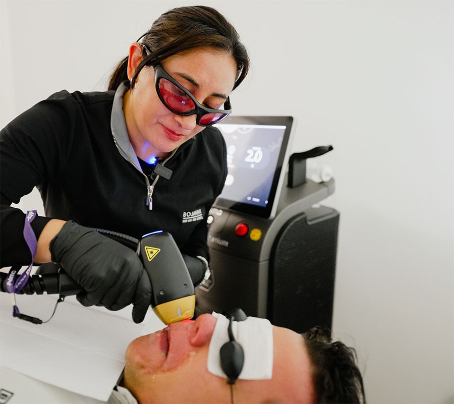 depilación laser ipl bogotá