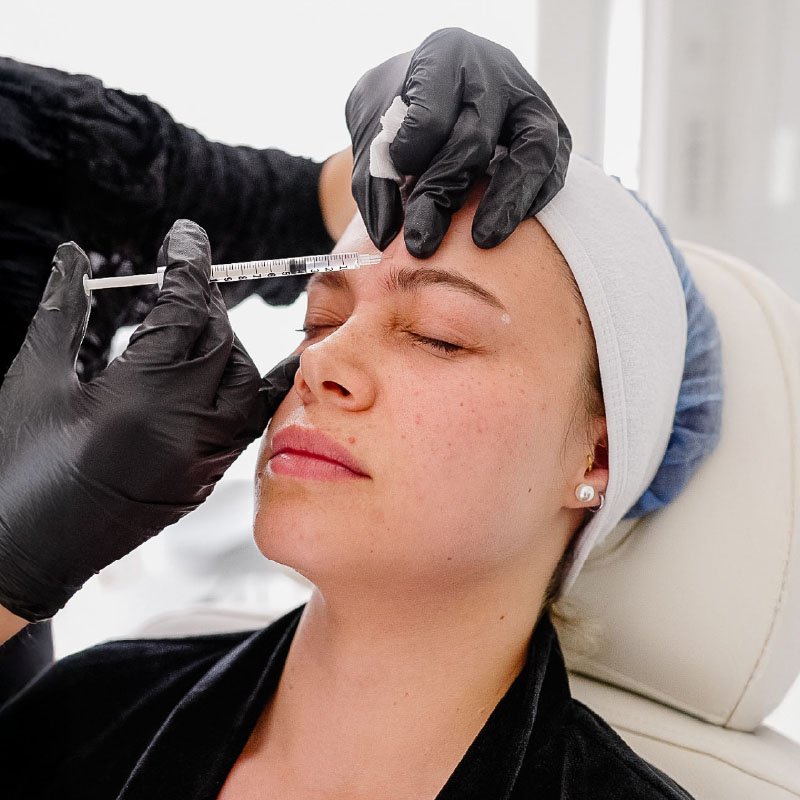 toxina botulinica - botox