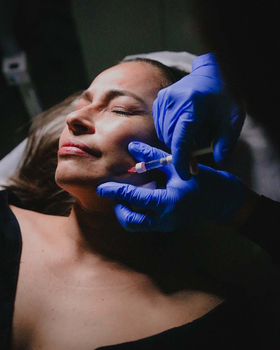 RESTYLANE GB 02 Bojanini Colombia