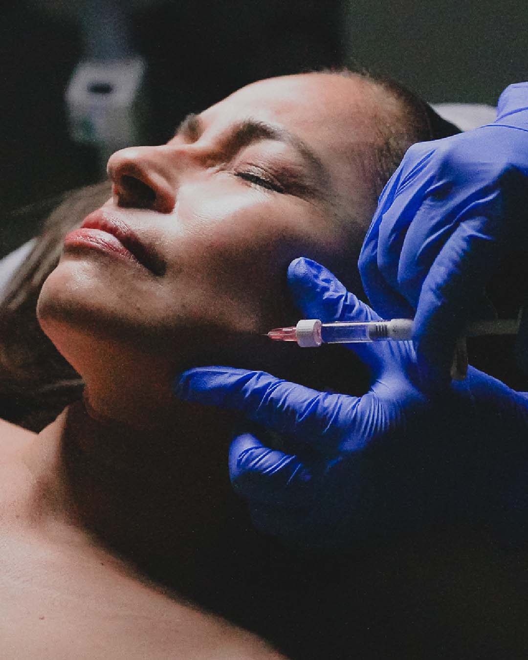 RESTYLANE GB 04 Bojanini Colombia