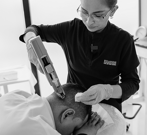 tratameinto-plasma-capilar-bojanini