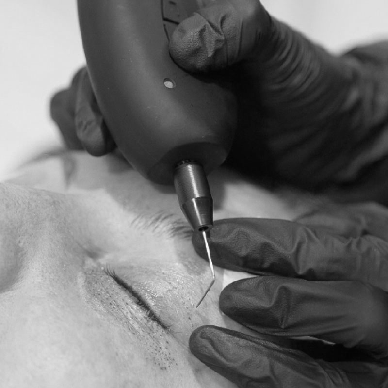 INYECTABLES-14 inyectables-14