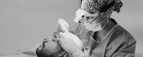 capilar-implante-capilar